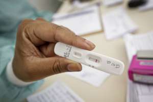 Covid-19: Brasil registra 229 óbitos e 64,36 mil casos em 24h |