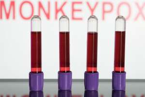 Primeiras vacinas contra varÃola dos macacos devem chegar em setembro | Reprodução